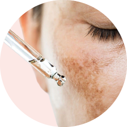 Dark Spot Treatments