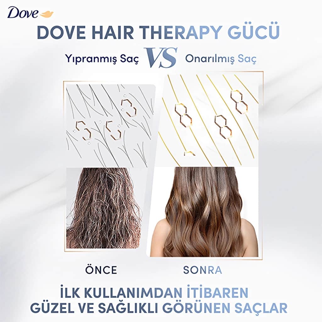 Dove بلسم دوف لترطيب الشعر وعلاجه، 170 مل - 4