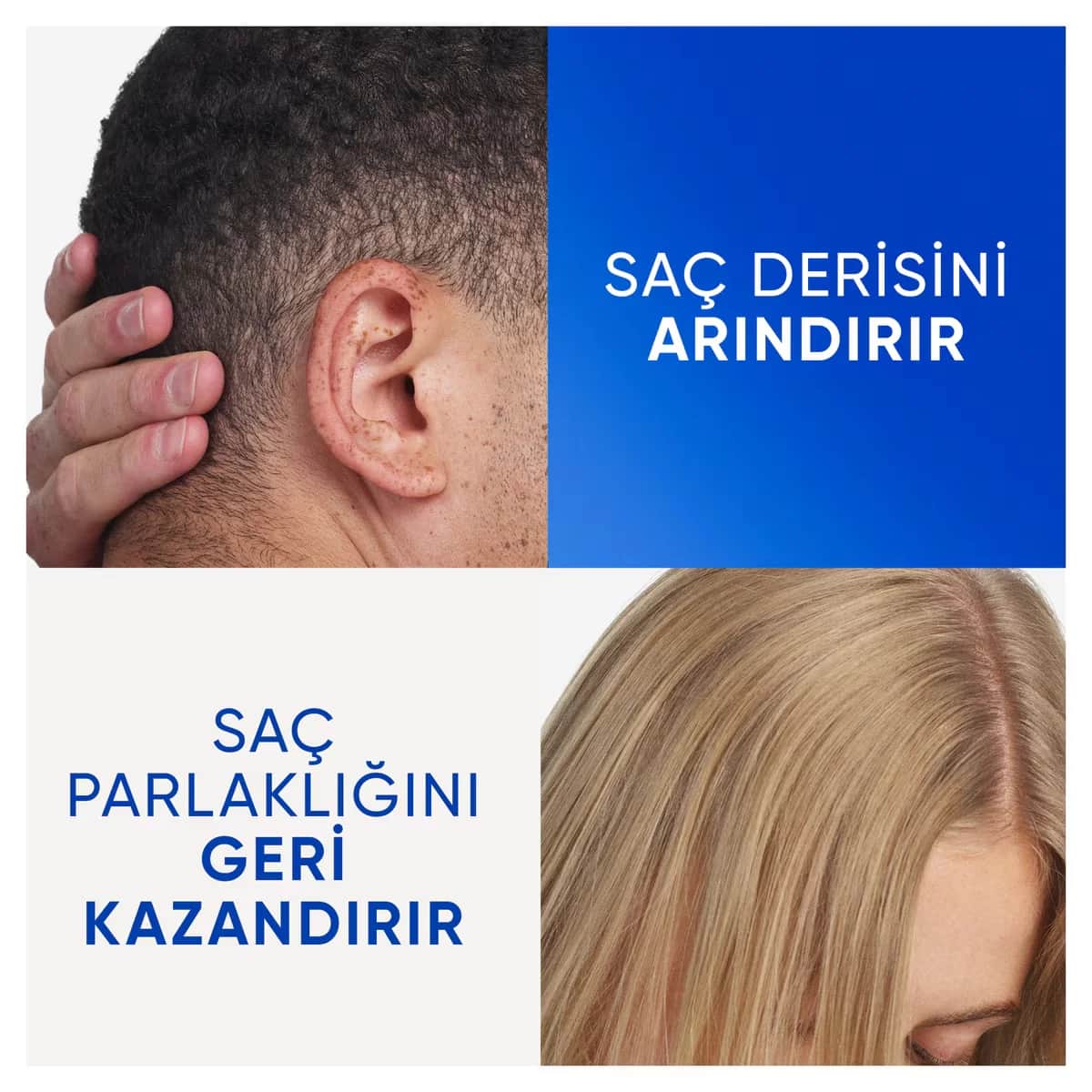 Head &amp; Shoulders شامبو هيد آند شولدرز المضاد للقشرة بخل التفاح 330 مل