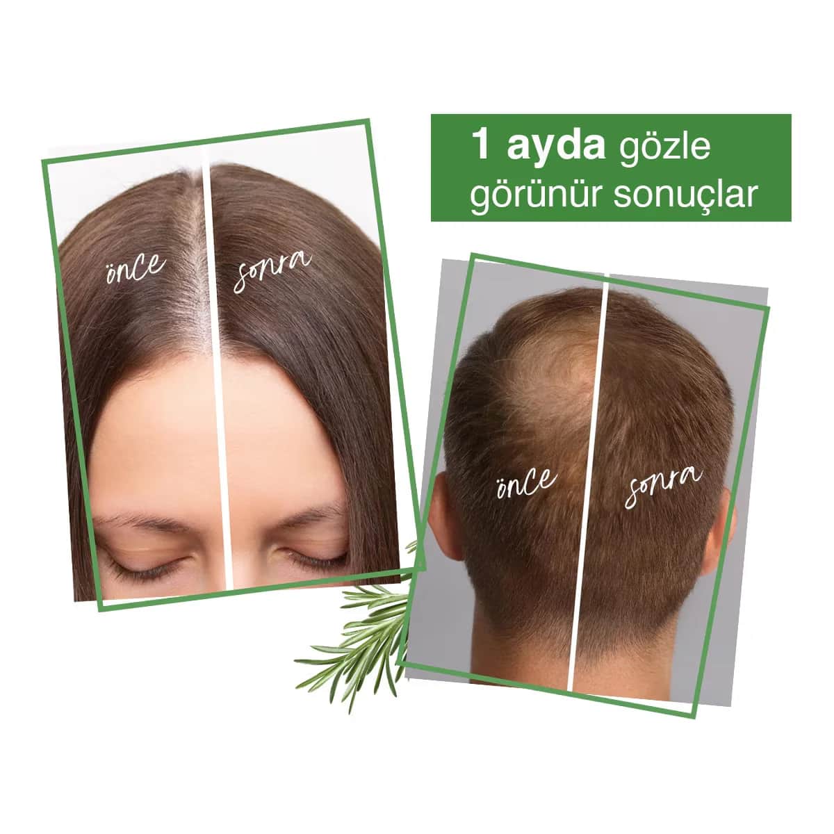 Yoon Rosmarin Shampoo für schnelles Haarwachstum und Haarausfallprävention 400ml