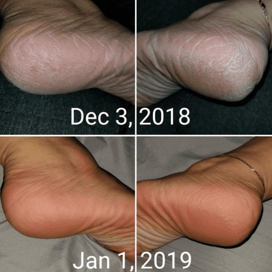 O'Keeffe's Foot Cream for Cracked Skin 91g - 6