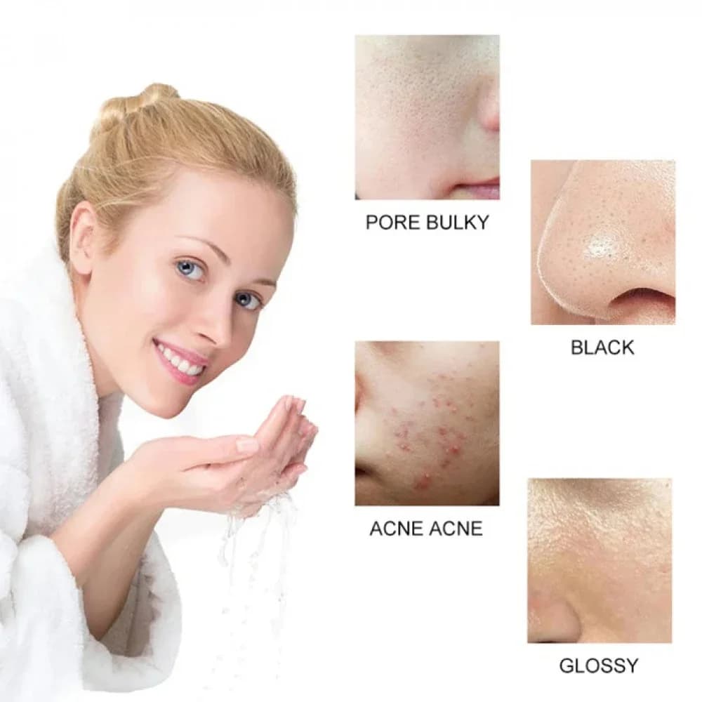 Kollagenreiniger und aufhellende Waschung 100 ml von Itchen Beauty