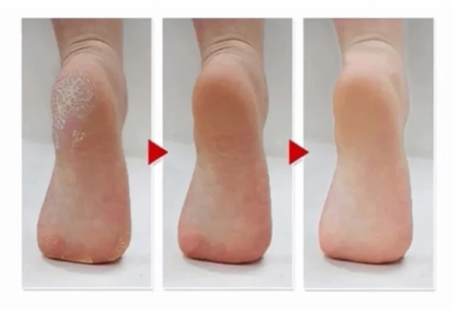 Fußpeeling-Socken von M Beauty