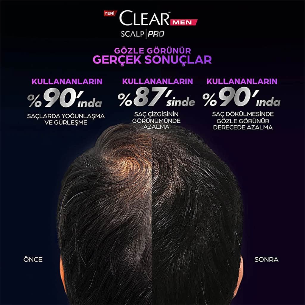 Clear Men Scalp Pro Strengthening Shampoo Effective Against Hair Loss And Dandruff 300 ml - 6