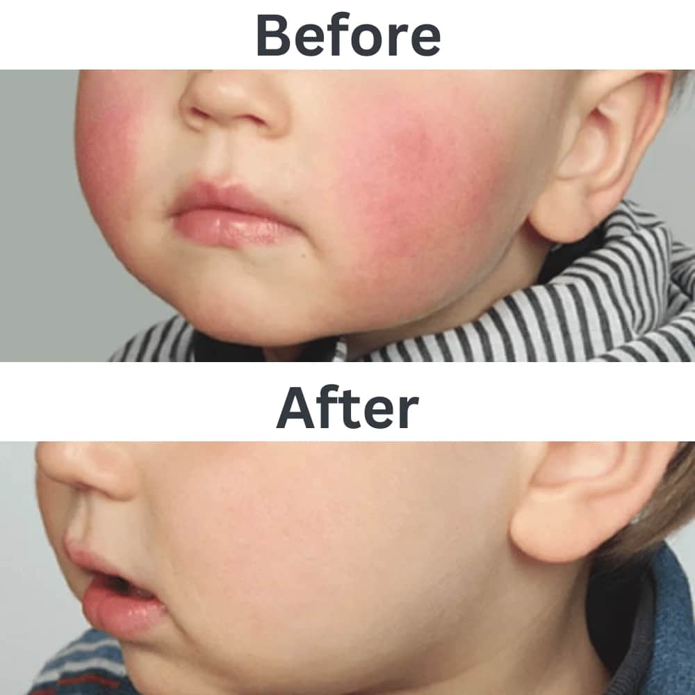 Isdin Children's Skin Soothing and Moisturizing Cream 50ml - 2
