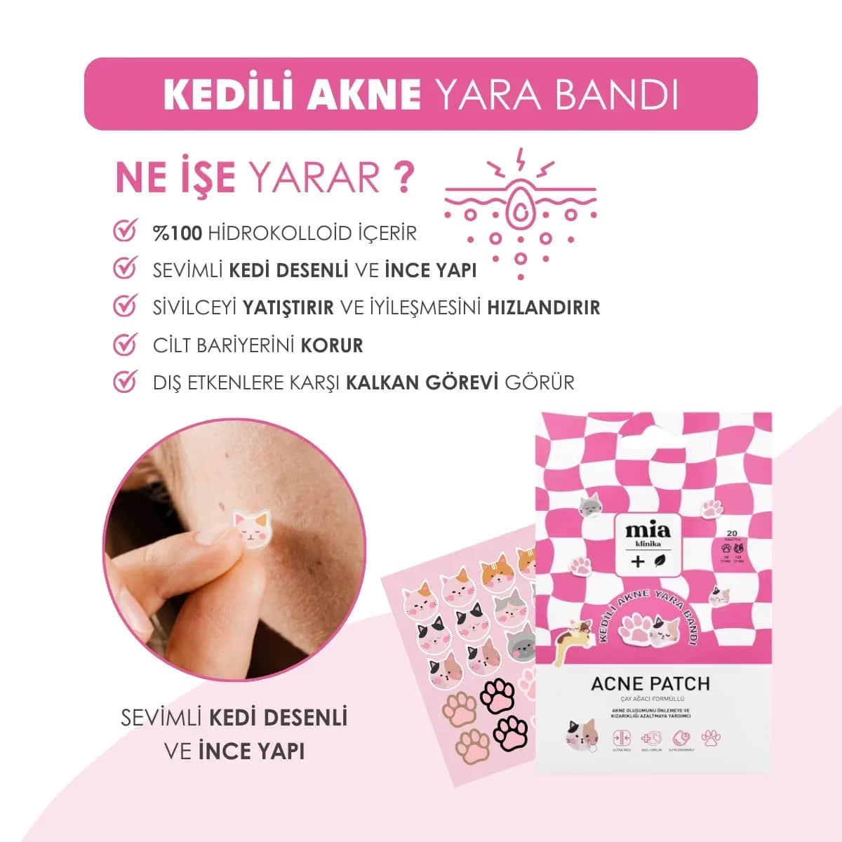 Патчи от прыщей с котом 20s от Mia Clinica
