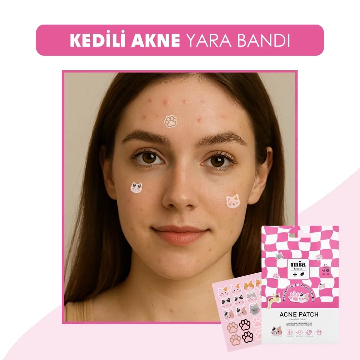 Патчи от прыщей с котом 20s от Mia Clinica