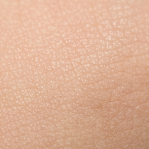 skin texture